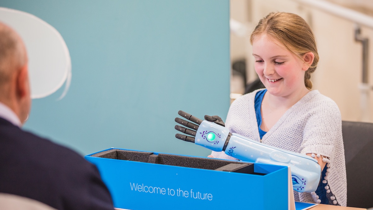 Amazing Company Gives Young STAR WARS Fan a BB-8 Decorated Bionic Arm_1